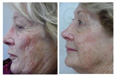 Your Natural Skin Care Statement Start Here!