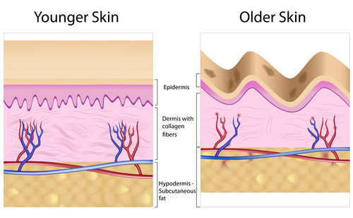 Causes of Age Spots