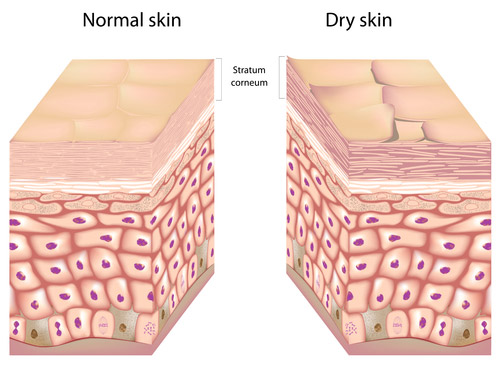 Normal Skin Vs Dry Skin